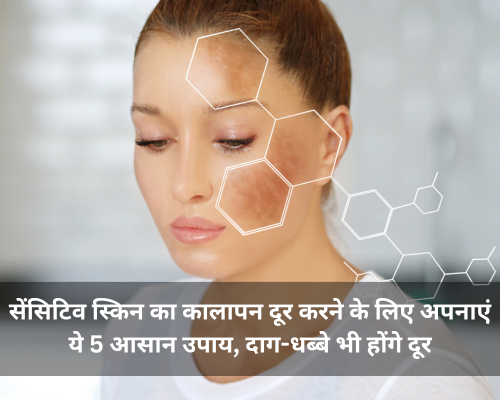 सेंसिटिव स्किन का कालापन दूर करने के लिए अपनाएं ये 5 आसान उपाय, दाग-धब्बे भी होंगे दूर