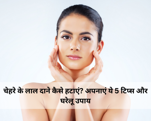 चेहरे के लाल दाने कैसे हटाएं? अपनाएं ये 5 टिप्स और घरेलू उपाय
